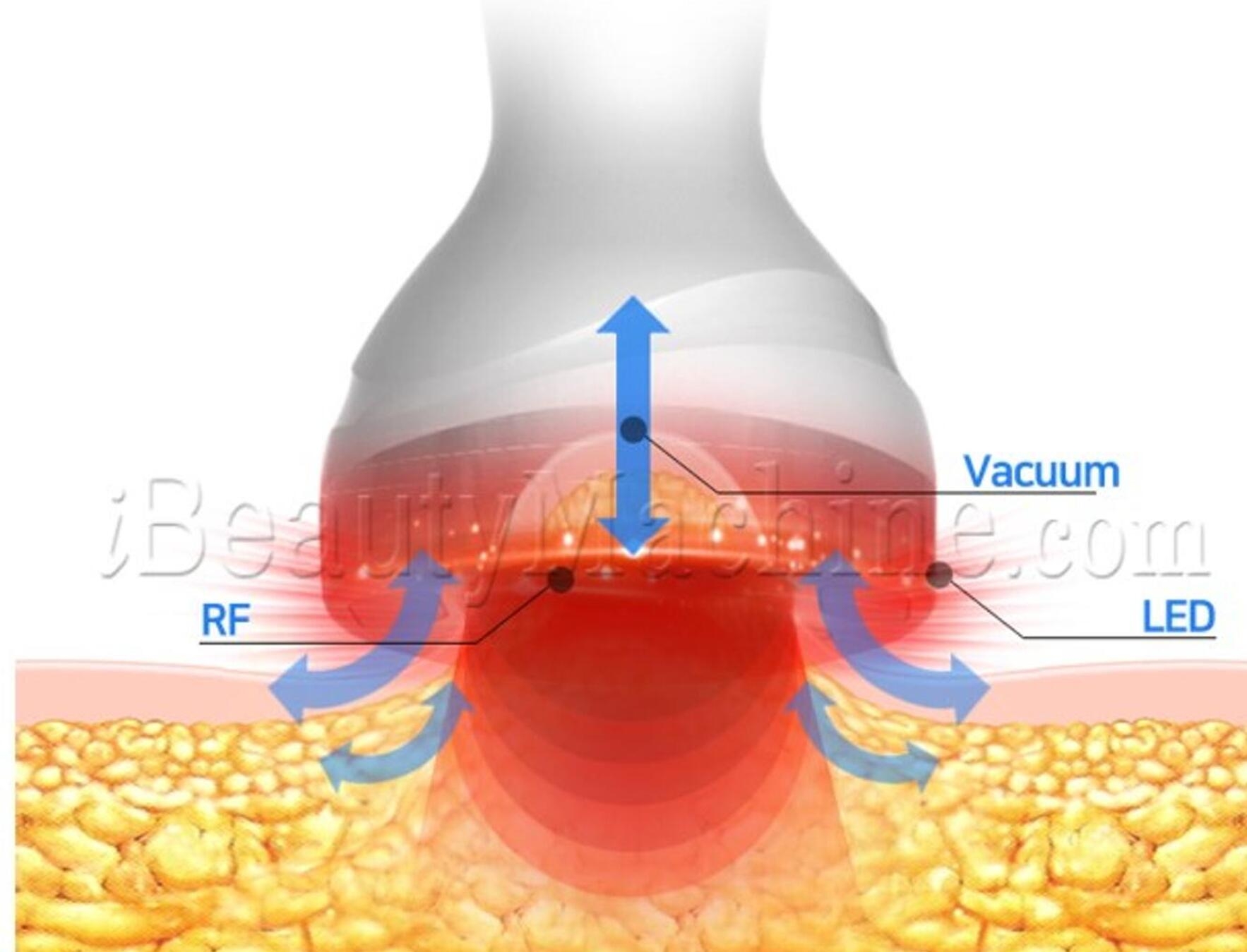 best ultrasonic cavitation machine