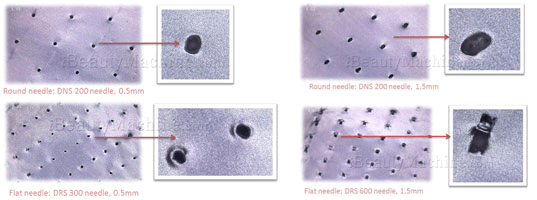 micro needle roller system, micro needle skin roller, dermal needling