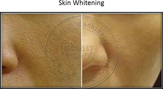 Skin Whitening