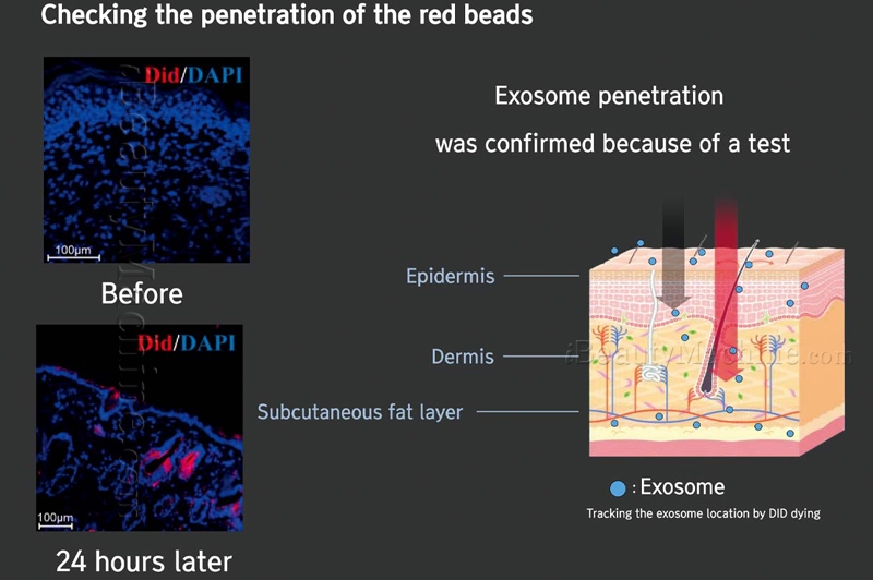 2XSOME Skin Penetration