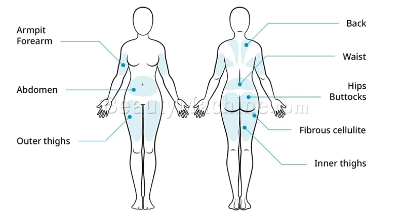 dr lipo+ treatment area