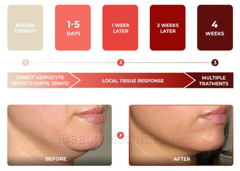 Dr. Lipo+ V Results