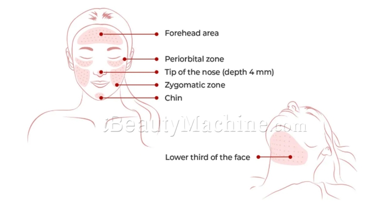 Dr. Lipo+ V treatment area