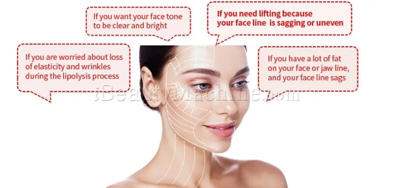 LIPO VELA V treatment area