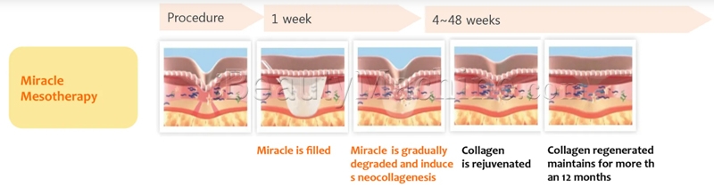 Miracle Action of Mechanism