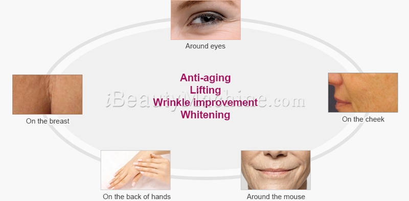 Miracle L Treatment Area