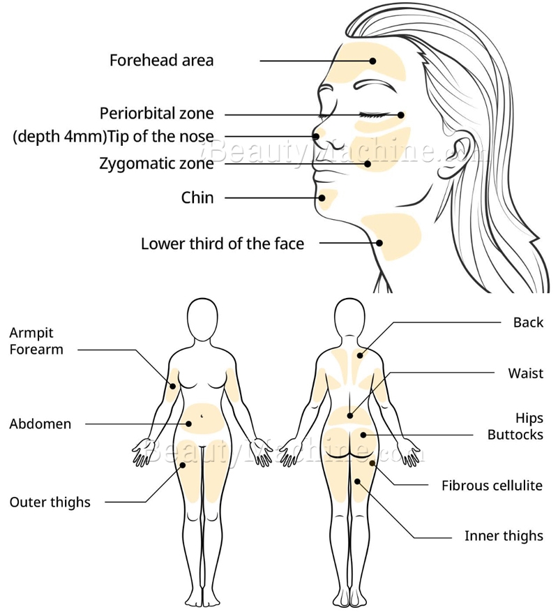 Prime Dr. Lipo+ Treatment Area