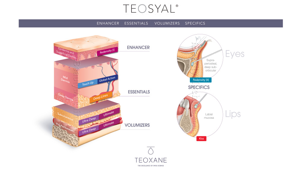 Teosyal Dermal Filler Range Chart