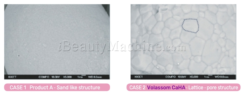 VoLassom CaHA patented volasom