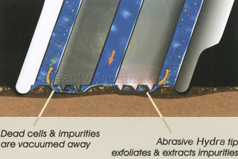 hydra dermabrasion device working theory