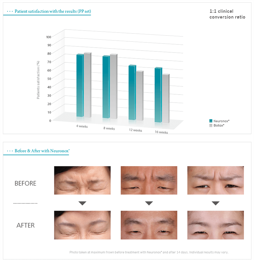 Neuronox result