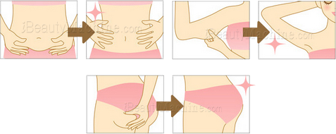 ultrasound fat reduction, ultrasound body slimming