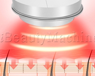 rf and red light therapy