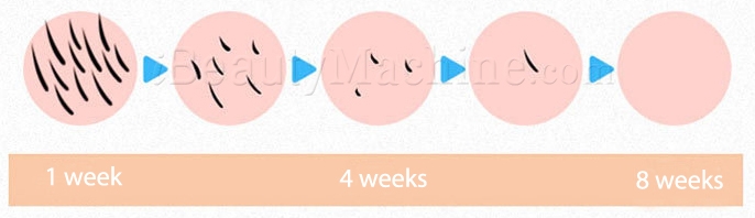 IL treatment result