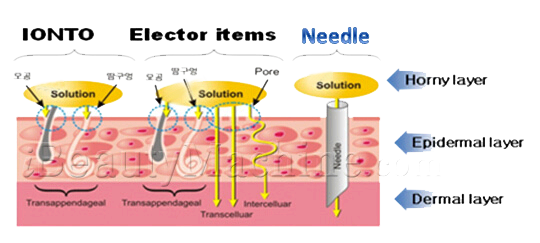 Derma Roller Chart