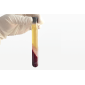 PRP Tubes | 8ml/30ml Glass Tubes | Sterilized Individual Package | Japan Imported Sodium Citrate+Separation Gel | 4pcs/Box