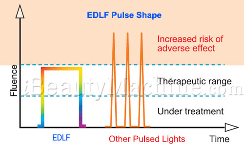 ipl laser hair removal, hair removal systems