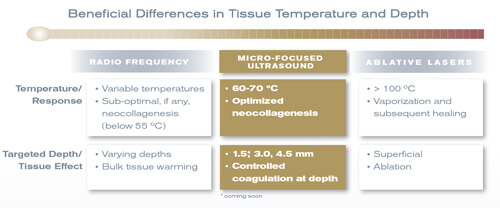 ultrasound skin tightening machine