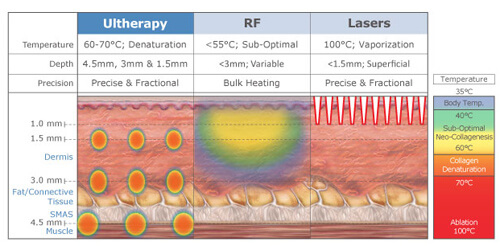 what is altherapy, altherapy machines