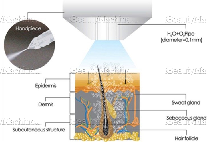 Jet peel machine