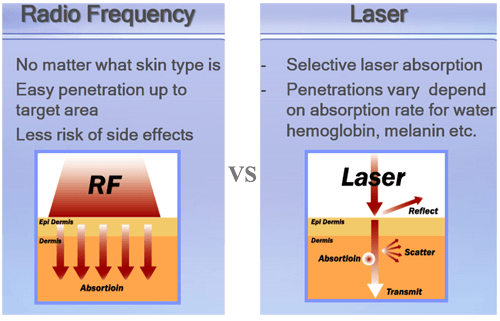 Needle rf fractional, Difference between Fractional micro needle RF and laser
