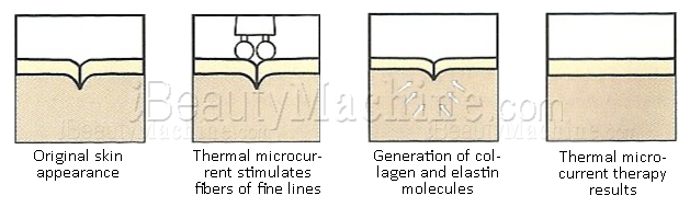 Bio-microcurrent treatment principle