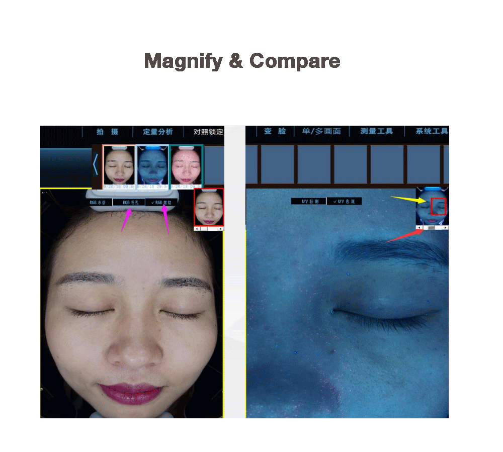 facial skin analyzer machine