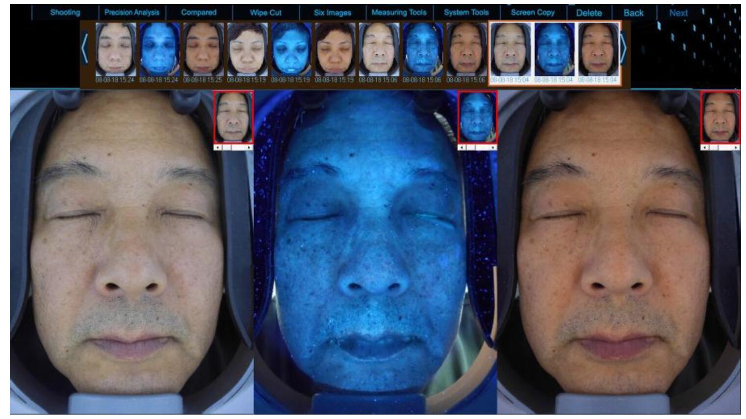 facial skin analyzer machine