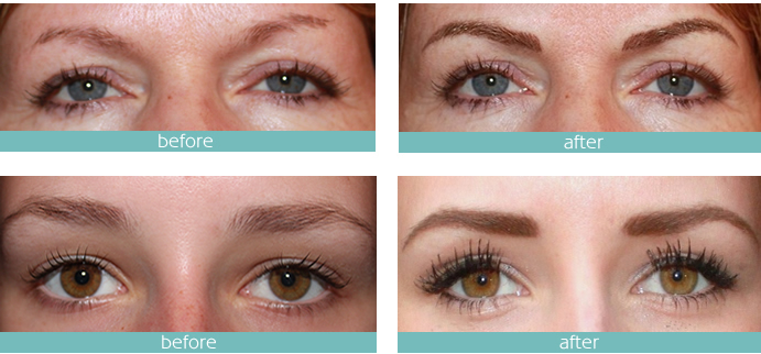 micro-pigmentation-eyebrows-needle tips