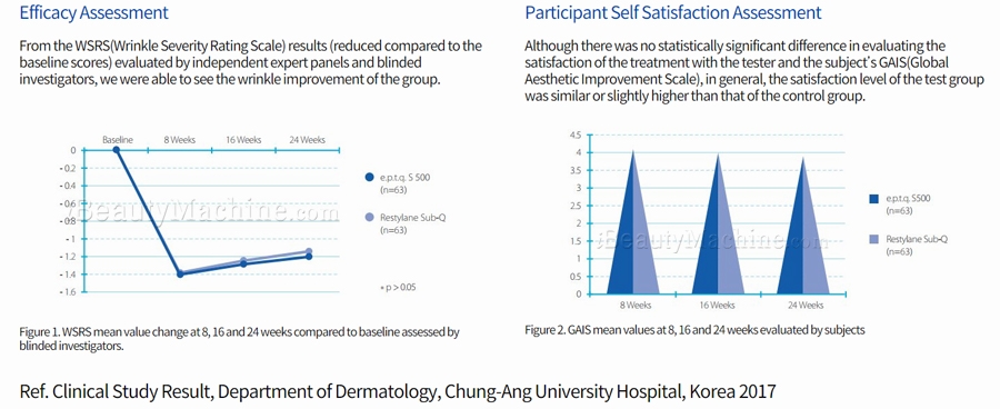 EPTQ S500 with Lidocaine FILLERS proven result