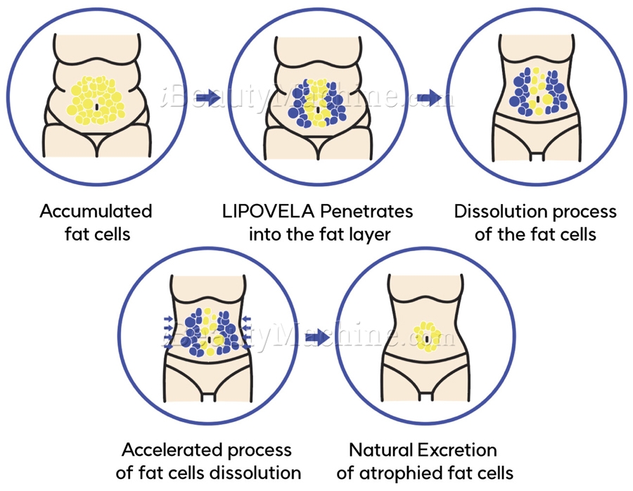 Lipo Vela Main Ingredient Active